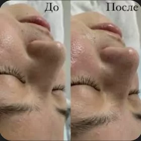 salon ýüz çistka