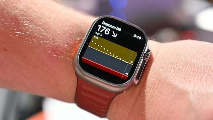 Apple 2027-nji ýyla çenli sagatlara gandaky şekeriň derejesini ölçemek funksiýasyny goşar