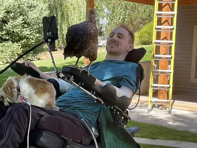 Neuralink-iň çibi oturdylan meýletinçi bir hepdede pikiriň güýji bilen wideo oýun oýnamagy öwrendi