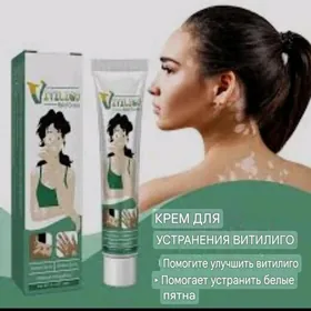 vitiligo krem