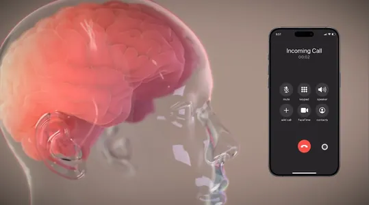 Ilon Maskyň Neuralink kompaniýasy 2031-nji ýyla çenli ýylda 20 müň adama çip oturdar