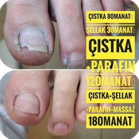 Pedikyur edyän Parafin Massaż