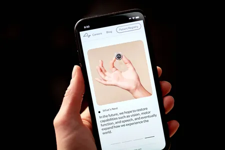 Neuralink pikiri tekste öwürmek üçin niýetlenen implantyň synaglaryna başlar