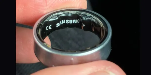 Батарея «умного» кольца Galaxy Ring вздулась прямо на пальце владельца