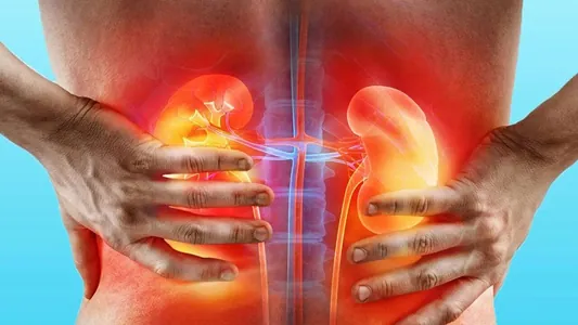 Число людей с хроническими болезнями почек в мире за 35 лет удвоилось