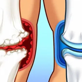 maz krem маз крем ayak agry