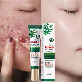 Dügürtik aýyrýan nabor