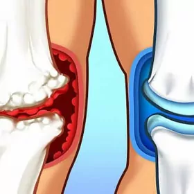 maz krem маз ayak omurga agry