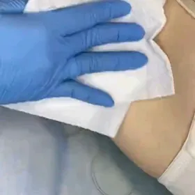 depilyasiya wosk 🫶