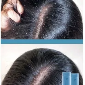 exper goñak aýyryjy