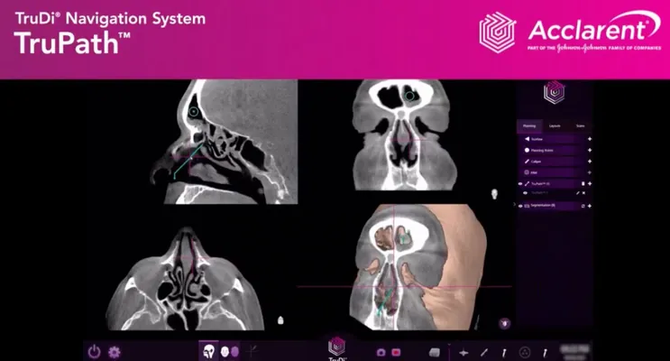 Lukmançylykda emeli aňyň artmagy hassalaryň şikes almagyna sebäp bolup bilýär