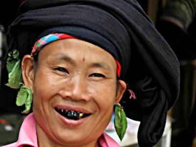 Wýetnamda 2000 ýyl ozal dişleri garaltmak däbi bolupdyr: bu geň däbiň syry açyklandy