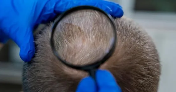 Победа над облысением: японские ученые нашли секретную клетку для непрерывного роста волос