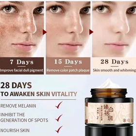 yüzdaki yakal ayyryan krem