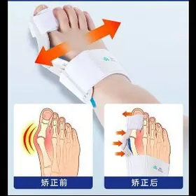 Barmak duzediji Fiksatr