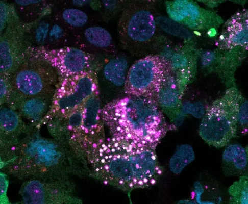 Bedende süýjüni kadalaşdyrmagyň täze mehanizmi diabeti bejermäge çemeleşmäni üýtgedýär