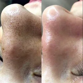 Yüz çistka hyzmaty bugda