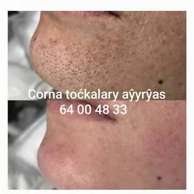 Model gerek ŷūz ćiska